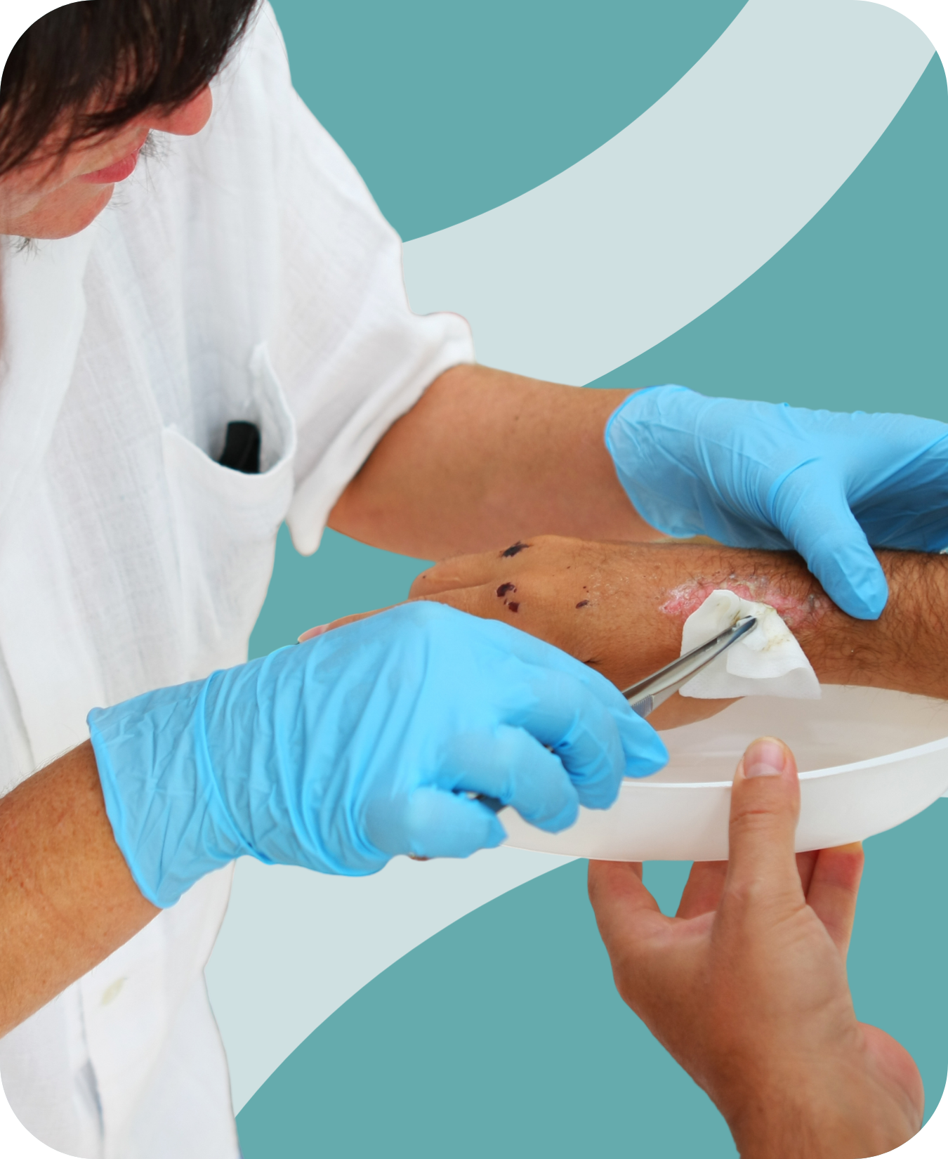 Wound Care-2 Wound Care-2